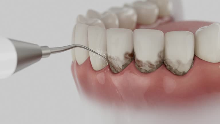 Reliable Dental contractor in Cudjoe Key, FL by Dentist Open Now